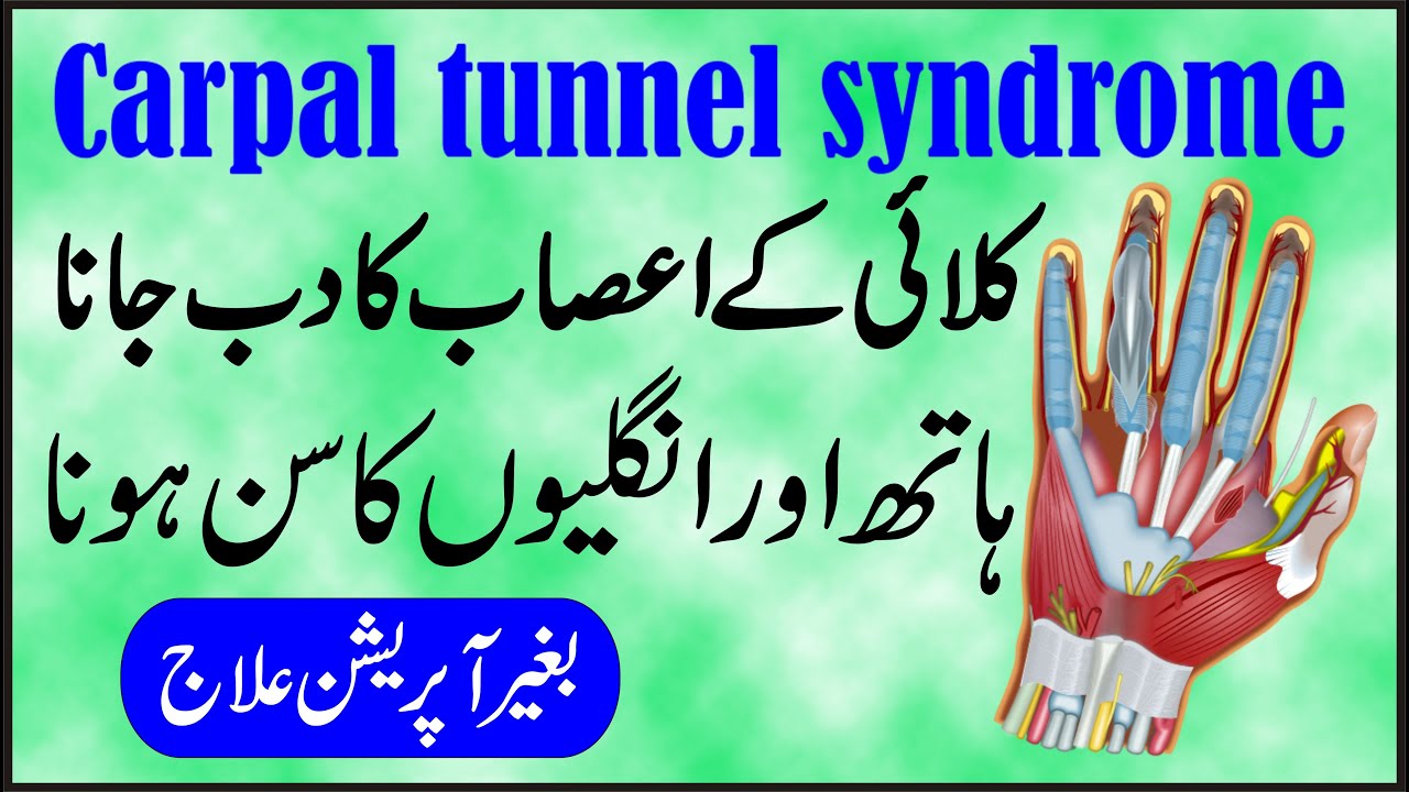 Carpal tunnel syndrome nas ka dab jane in urdu hath ki ungliyo me