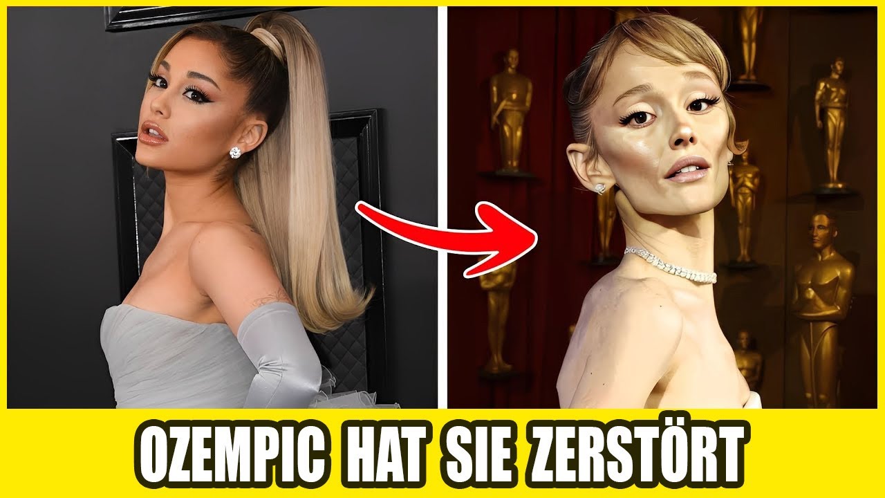 35 Stars, Deren Gesichter Durch „Ozempic“ Zerstört Wurden – Vorher & Nachher, Das Jeden Schockiert!