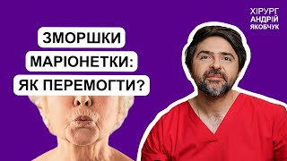 ЗМОРШКИ МАРІОНЕТКИ кричать про сум, втому та старість: як прибрати? Відповідає пластичний хірург