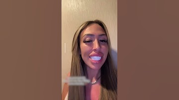 New Turkey Teeth Fail 😱
