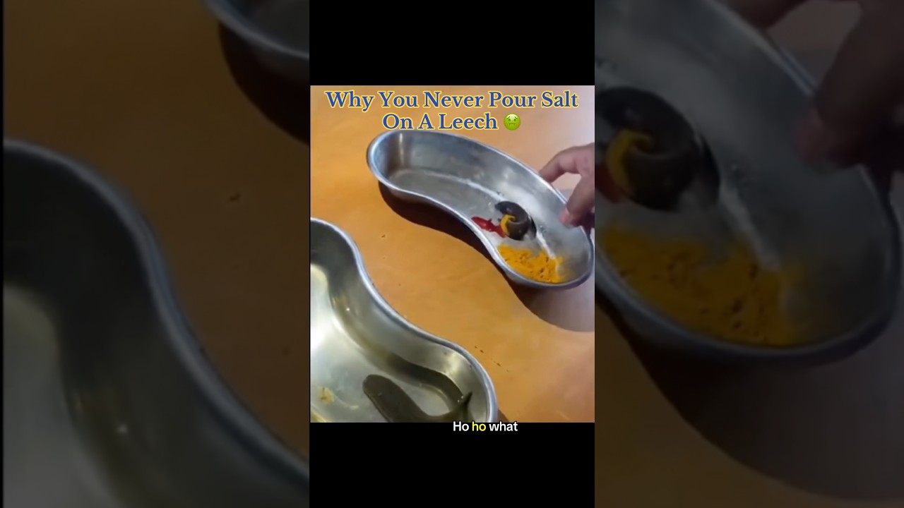 Why You Never Pour Salt On A Leech… 🤢 