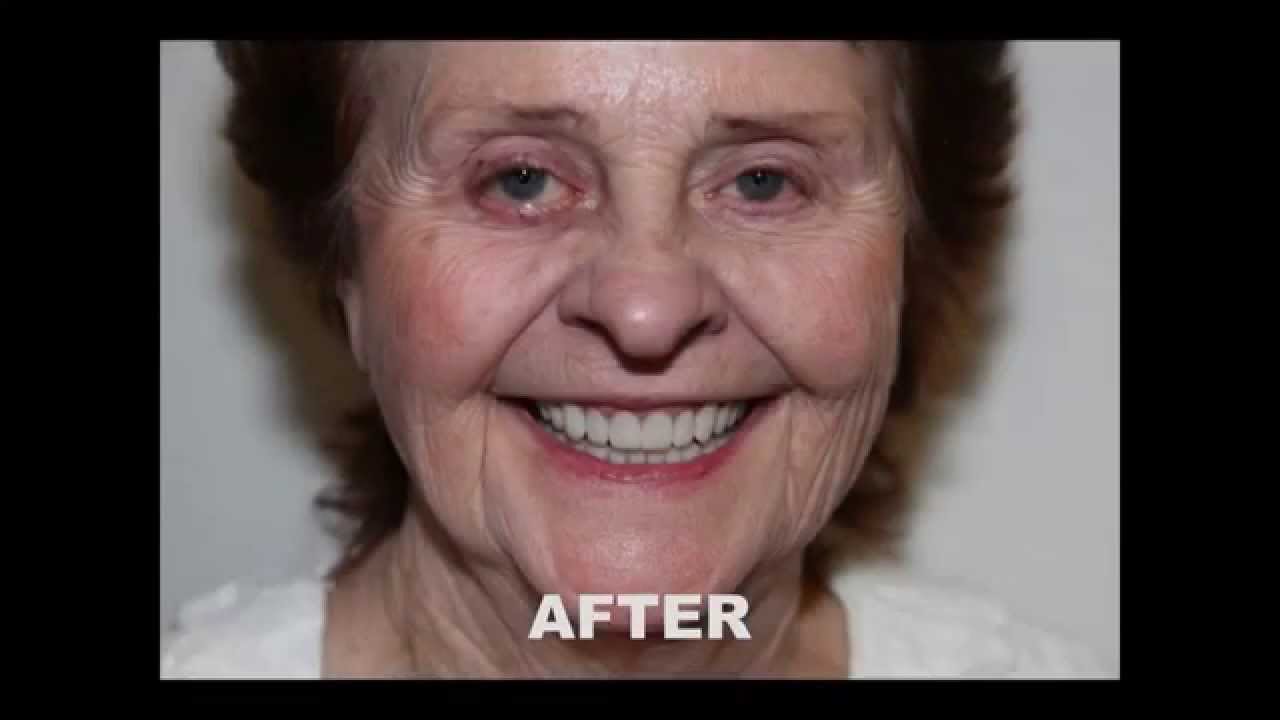 Smile Makeover - Joy at our Phoenix, AZ Dentist Office