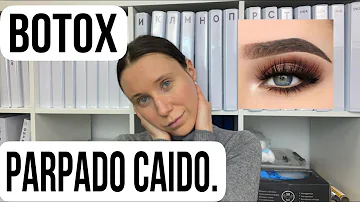 ¿Qué causa la pesadez de párpados después del Botox?