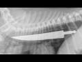 People and Animals Who Had Foreign Objects in Their Bodies