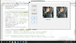GUI using matlab and  image processing