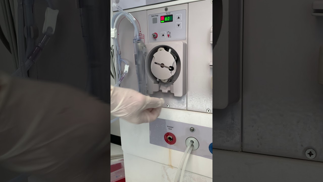 SETTING UP DIALYSIS MACHINE PART 2 YouTube
