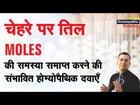 चेहरे पर तिल || Moles || Natural Homeopathic remedies || होम्योपैथिक उपचार