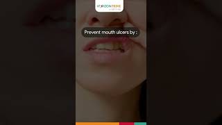 Reasons For  Mouth Ulcers | Causes | Horizon Hospital | Thane | Mumbai