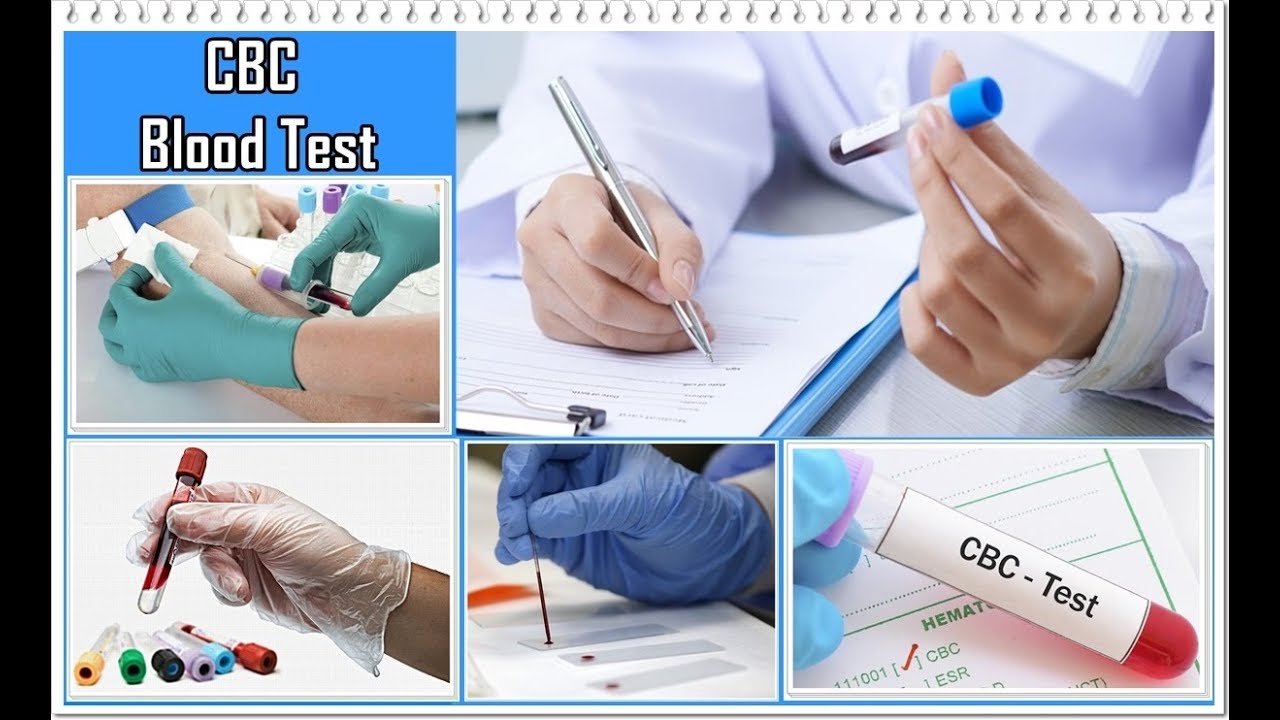 Какая ты кровь тест. Blood Test Results. Biochemical Blood Test. General Blood Test. Clinical and General Blood Test.