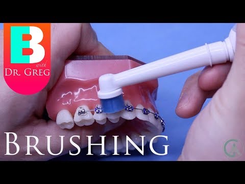 Brushing Your Teeth with Braces