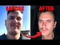 How i lost 30lbs of face fat in 6 months