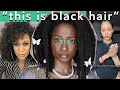 When Being Biracial Becomes the Representation of Black Hair : Texturism &amp; Erasure.