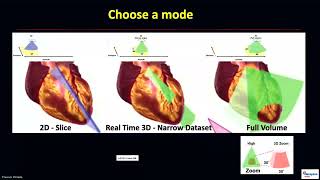 Crystal 2026  BASICS OF 3D ECHO BY DR  SATISH G
