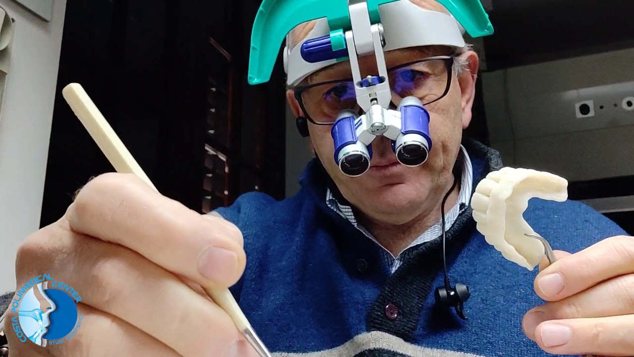 Protesi dentale in 3D. Progetto exocad e simplant. Stampa 3d