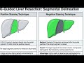 ICG IN SURGICAL PRACTICE 