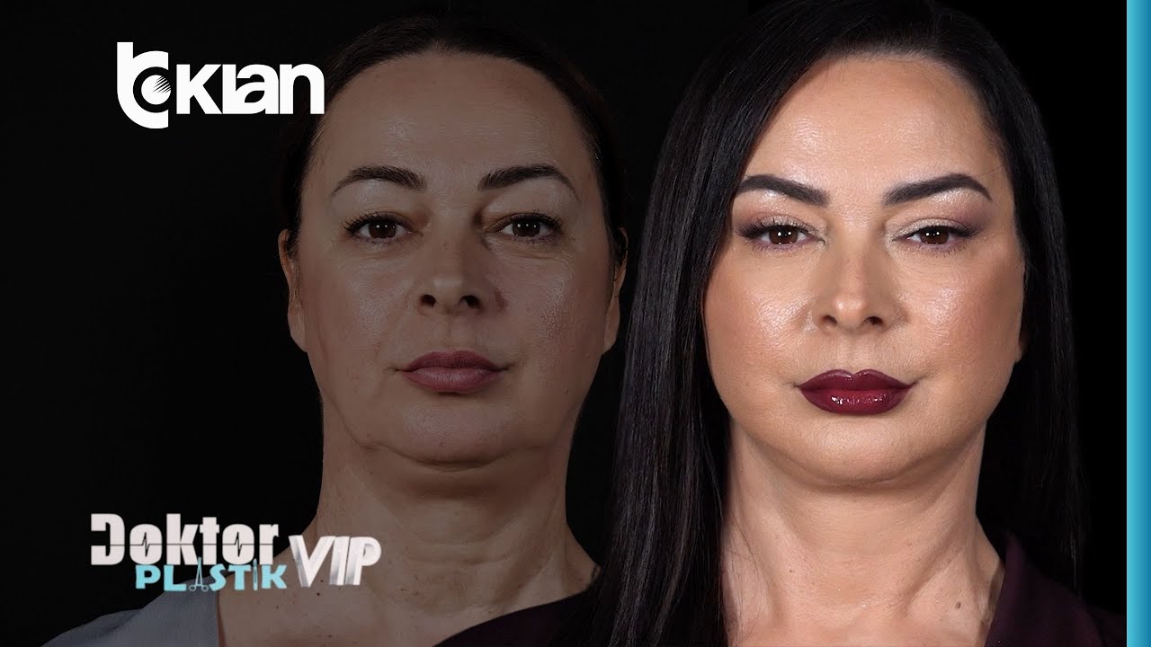 Doktor Plastik i “ndërron” fytyrën Julia Ilirjanit | 7 Shkurt 2026 Emisioni i plotë