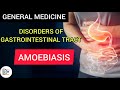 AMOEBIASIS - DISORDERS OF GASTROINTESTINAL TRACT
