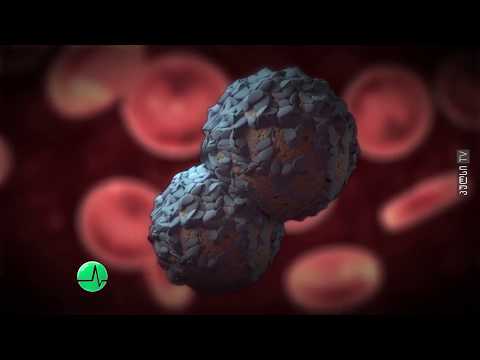 ვიროთერაპია – ახალი სიტყვა სიმსივნური დაავადების მკურნალობაში