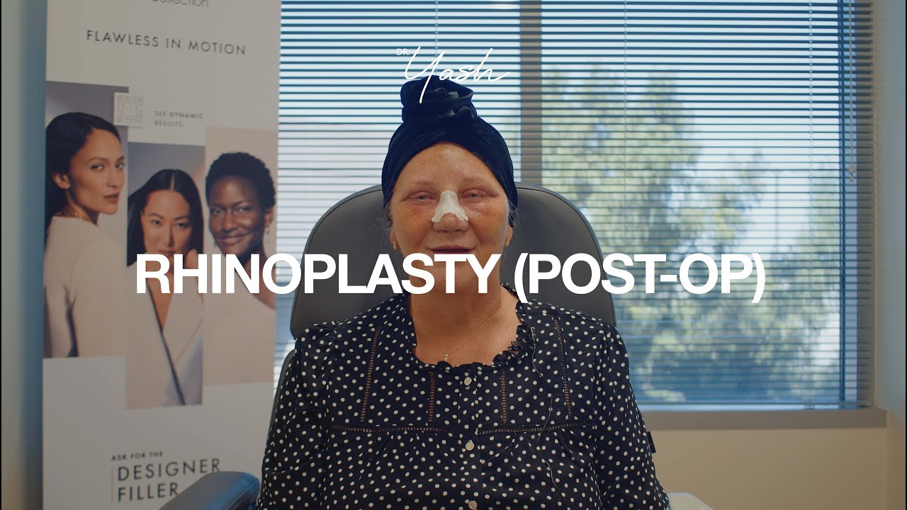 Dr Yash - Rhinoplasty (PostOp)
