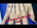 كيف بعالج علامات شيخوخة جلد اليدين بأقل تكاليف ممكنة و بنتائج رائعة