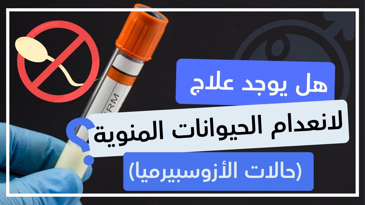 هل يوجد علاج لانعدام الحيوانات المنوية (حالات الأزوسبيرميا)؟