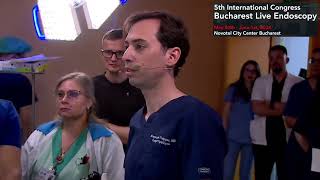 ESD at the left colon performed by Georgios Mavrogenis in  Bucharest Live 2024.
