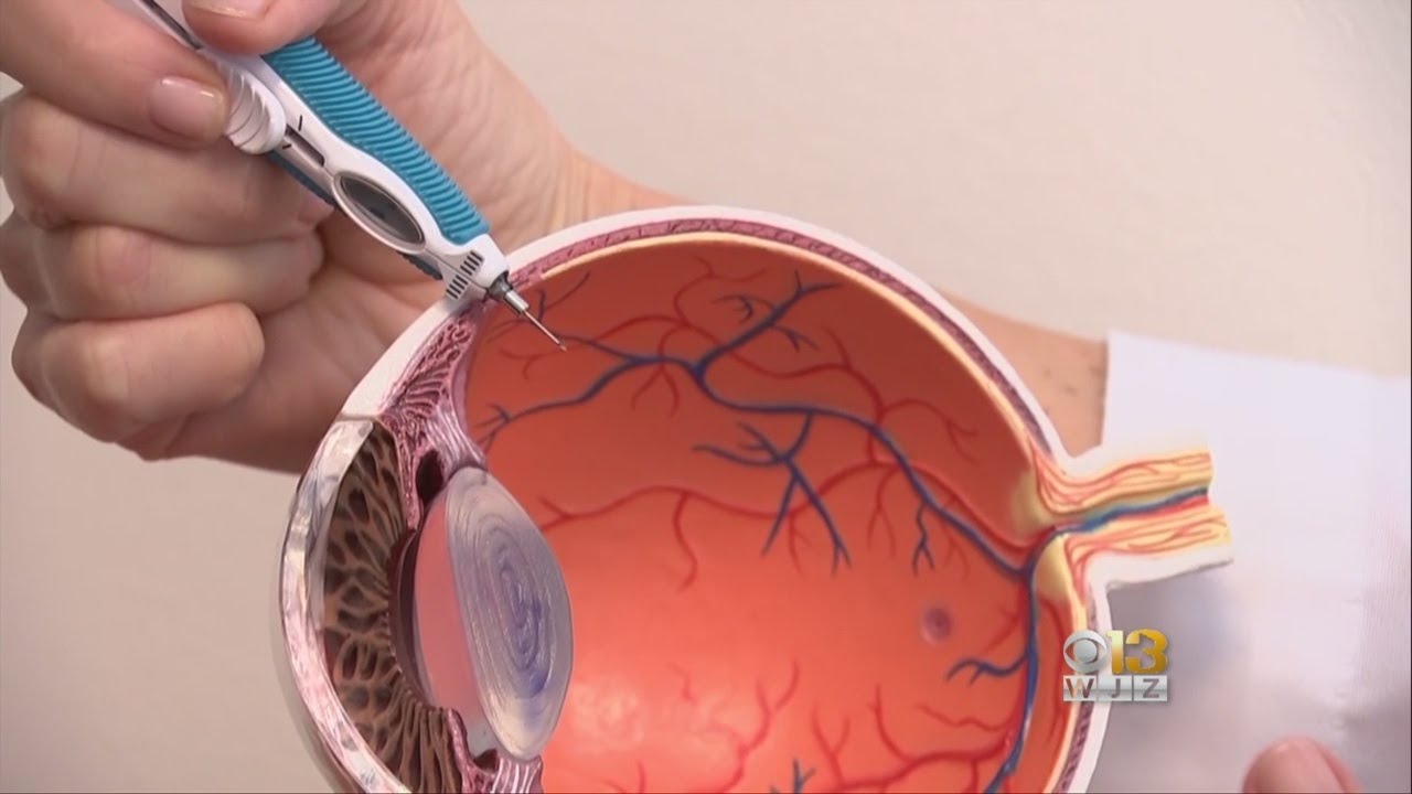 WJZ HealthWatch: Eye Exam