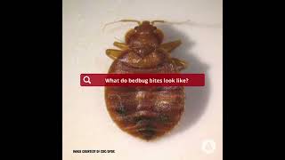 What Do Bedbug Bites Look Like?