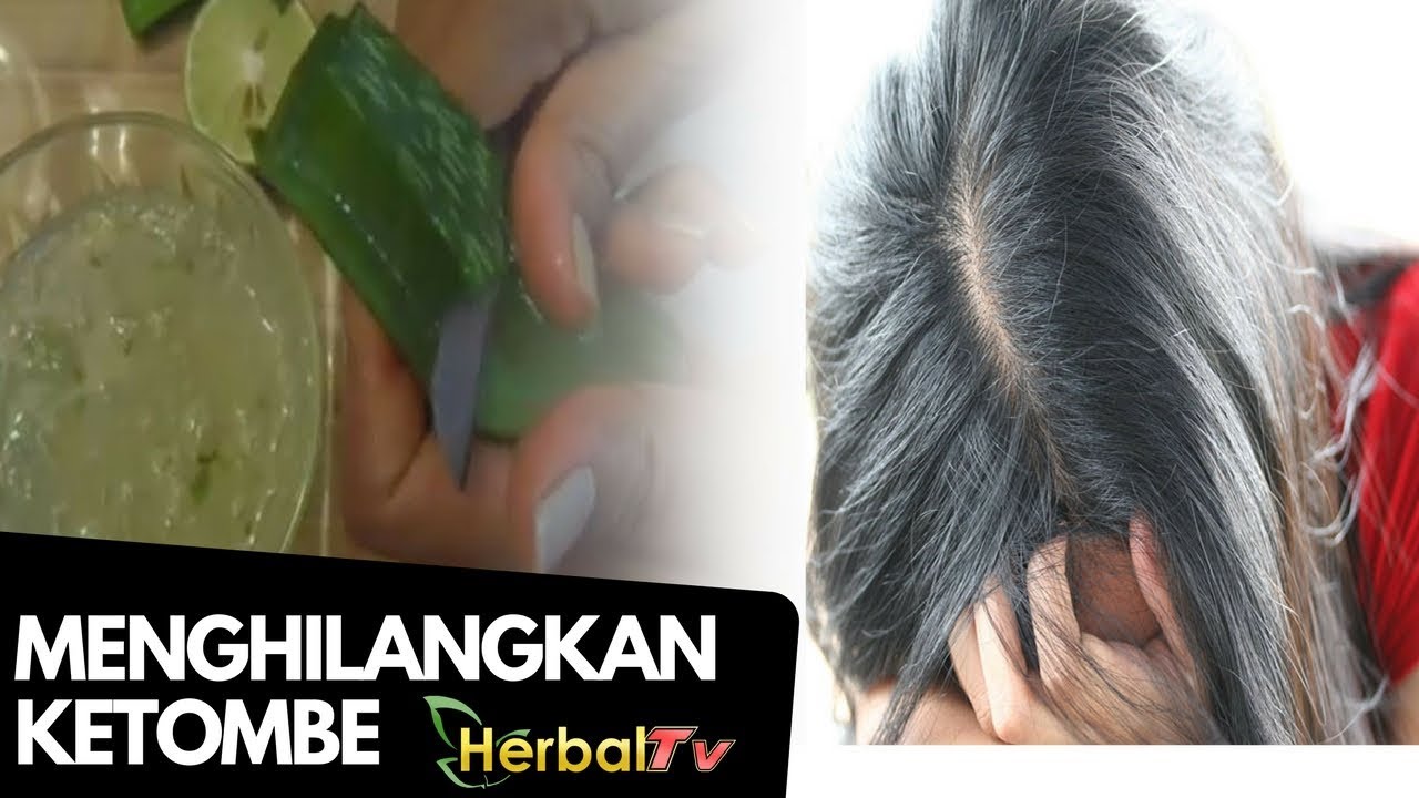 Ketombe Susah Hilang Atasi Dengan Bahan Dapur Berikut Terbukti