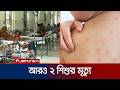 হাম ও উপসর্গে ২৪ ঘণ্টায় ময়মনসিংহ মেডিকেলে আরও ২ শিশুর মৃত্যু | Haam | Measles | Jamuna TV