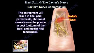 The Baxter's Nerve and plantar fasciitis  - Everything You Need To Know - Dr. Nabil Ebraheim