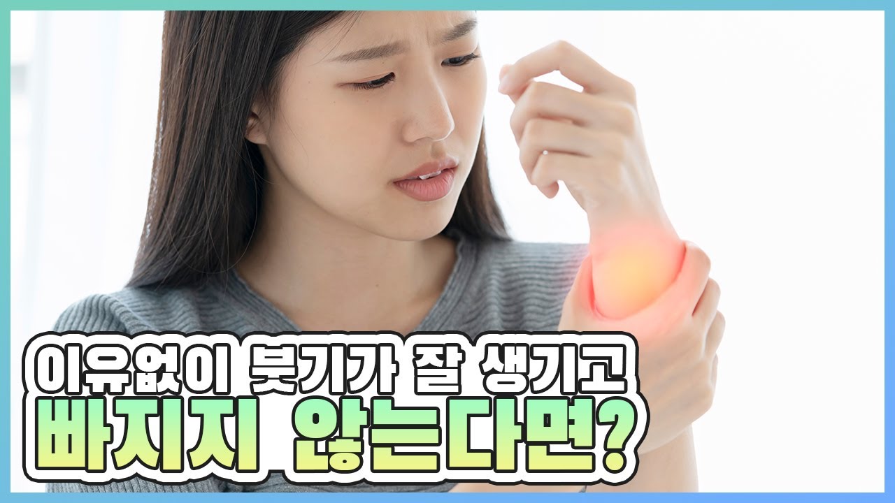 림프부종을 개선하는 방법 : 림프계의 펌프를 이용해 보세요 - YouTube