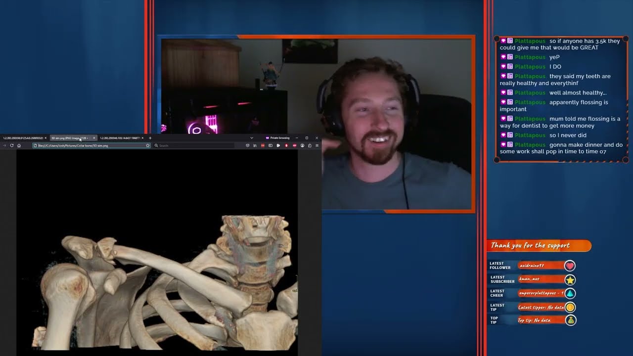 First stream back after broken collarbone & Plate Up - Stream 79 Part 1 - Stream Archive - 20/03/25