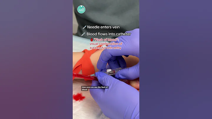 IV Insertion Explained 💉🩸 #RN #BSN #futurenurse