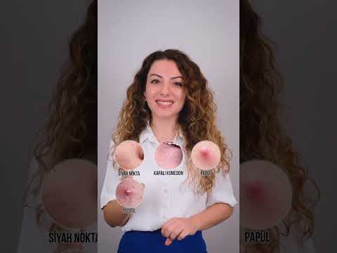 Sivilce Tipleri Nelerdir? Sivilceler Nasıl Oluşur? - Doç. Dr. Ezgi Özkur