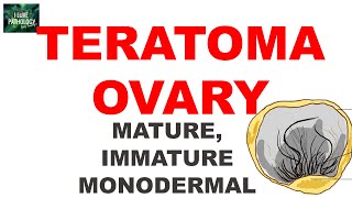 TERATOMA-OVARY:  Ovarian Tumor Series Part 5