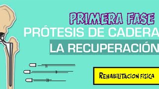 Rehabilitacion de protesis de cadera primera fase