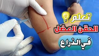 تعلم اعطاء الحقن العضل في الذراع بدلا من المؤخره_Learn to give the im injection in the arm