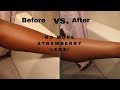 HOW TO GET RID OF STRAWBERRY SKIN PERMANENTLY (BUY NOW: LINK IN DESCRIPTION BOX)| JASMINE AND SIMONE