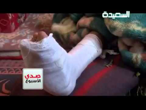 تقريرعن مقتل لطفي الوصابي شبكة وصاب 