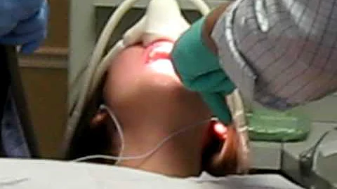 Wisdom Teeth For Goslin