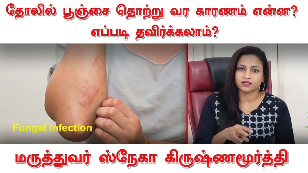 What causes fungal skin infections How to avoid  Dr Sneha Krishnamurthy  Beauty tips