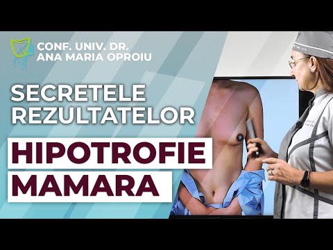 Totul despre dezvoltarea incompleta a glandei mamare