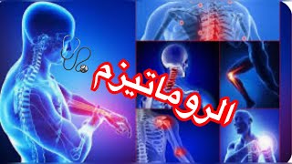 علاج آلام المفاصل والروماتيزم ?