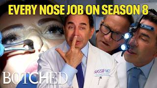 Botched Supercut: EVERY Nose Job on Season 8 (All Surgeries) | Botched | E!