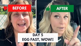 DAY 5 UPDATE on EGG FAST 🤯