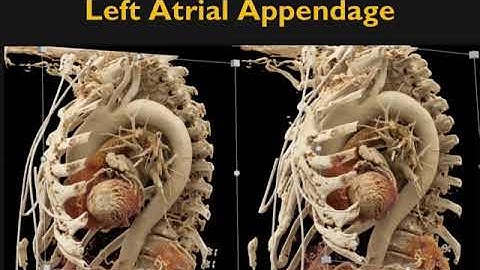 Cinematic Rendering in the Heart