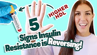 Signs Insulin Resistance is REVERSING! (Improving Insulin Sensitivity)