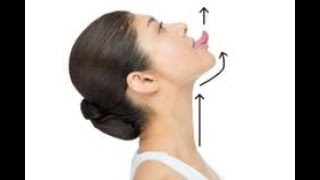 how to get rid of double chin  By Dr Zolati. Comment se débarrasser du double menton