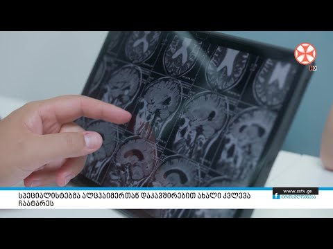 სპეციალისტებმა ალცჰაიმერთან დაკავშირებით ახალი კვლევა ჩაატარეს